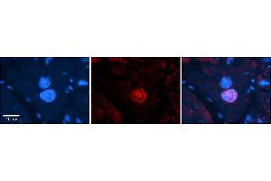 Rabbit Anti-NR5A1 Antibody  Catalog Number: ARP45620_P050 Formalin Fixed Paraffin Embedded Tissue: Human Adult heart  Observed Staining: Nuclear and some weak cytoplasmic Primary Antibody Concentration: 1:600 Secondary Antibody: Donkey anti-Rabbit-Cy2/3 Secondary Antibody Concentration: 1:200 Magnification: 20X Exposure Time: 0. (NR5A1 antibody  (Middle Region))