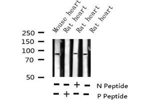 Western blot analysis of Phospho-ATRIP (Ser68) expression in various lysates