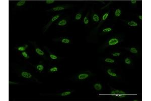 Immunofluorescence of monoclonal antibody to FOS on HeLa cell. (c-FOS antibody  (AA 1-100))