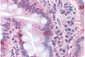 Human Small Intestine: Formalin-Fixed, Paraffin-Embedded (FFPE) (SEMA4B antibody  (Internal Region))