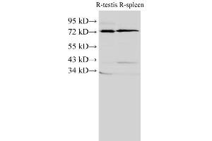 Western Blot analysis of Rat testis and Rat spleen using ANXA6 Polyclonal Antibody at dilution of 1:2000 (ANXA6 antibody)