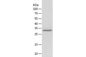 Western Blotting (WB) image for WD Repeat Domain 5 (WDR5) (AA 1-334) protein (His tag) (ABIN7125726) (WDR5 Protein (AA 1-334) (His tag))