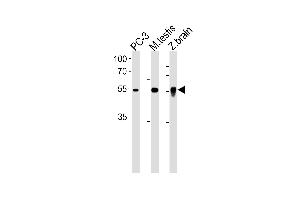DMRTA2 Antibody (C-term) (ABIN1881263 and ABIN2838900) western blot analysis in PC-3 cell line, mouse testis and zebra fish brain tissue lysates (35 μg/lane).