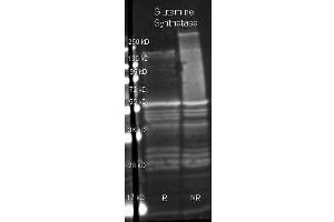 Goat anti Glutamine Synthetase antibody  was used to detect Glutamine Synthetase under reducing (R) and non-reducing (NR) conditions.