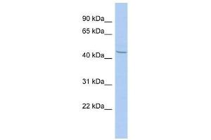 Western Blot showing ZBTB12 antibody used at a concentration of 1-2 ug/ml to detect its target protein. (ZBTB12 antibody  (N-Term))