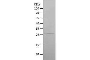 Western Blotting (WB) image for Protein Phosphatase 1, Regulatory (Inhibitor) Subunit 15A (PPP1R15A) (AA 464-674) protein (His tag) (ABIN7124666) (GADD34 Protein (AA 464-674) (His tag))