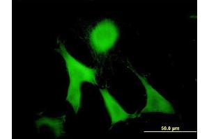 Immunofluorescence of monoclonal antibody to GAS2 on NIH/3T3 cell. (GAS2 antibody  (AA 1-110))