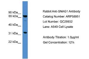 WB Suggested Anti-SNAG1  Antibody Titration: 0. (SNX18 antibody  (Middle Region))