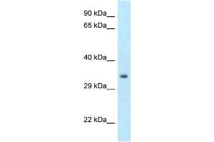 WB Suggested Anti-Hoxc11 Antibody Titration: 1. (HOXC11 antibody  (C-Term))