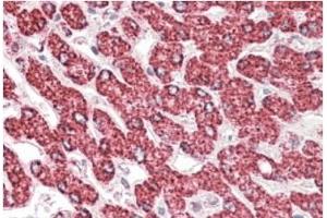 AP21283PU-N ETFB antibody staining paraffin embedded Human Liver at 3. (ETFB antibody  (Internal Region))