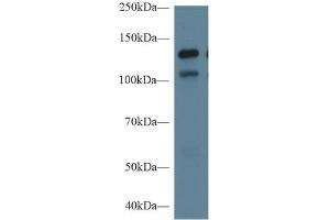 Rabbit Capture antibody from the kit in WB with Positive Control: Sample Human Hela cell lysate;.