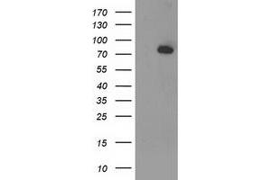 HEK293T cells were transfected with the pCMV6-ENTRY control (Left lane) or pCMV6-ENTRY ACSS2 (Right lane) cDNA for 48 hrs and lysed. (ACSS2 antibody)