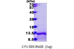 SDS-PAGE (SDS) image for Chemokine (C-C Motif) Ligand 3-Like 1 (CCL3L1) (AA 26-93) protein (His tag) (ABIN666646)