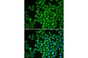 Immunofluorescence analysis of HeLa cells using COPS5 antibody (ABIN6291035).