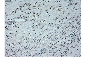 Immunohistochemical staining of paraffin-embedded Kidney tissue using anti-NEUROG1mouse monoclonal antibody. (Neurogenin 1 antibody)