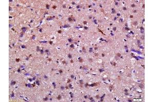 Formalin-fixed and paraffin embedded rat brain labeled with Anti-Syndetin Polyclonal Antibody, Unconjugated  at 1:200 followed by conjugation to the secondary antibody and DAB staining. (Syndetin (VPS50) (AA 3-100) antibody)