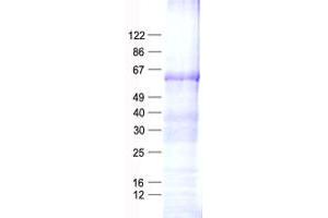 Validation with Western Blot (PFKFB3 Protein (His tag))