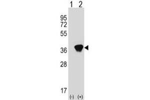 Western blot analysis of AKR1A1 antibody and 293 cell lysate (2 ug/lane) either nontransfected (Lane 1) or transiently transfected (2) with the AKR1A1 gene. (AKR1A1 antibody  (AA 293-325))
