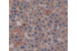 Figure. (Vitamin D-Binding Protein antibody  (AA 209-394))