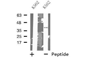Western blot analysis of extracts from K562 cells, using MRPL3 antibody. (MRPL3 antibody  (N-Term))