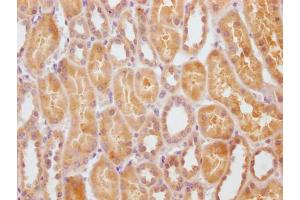 IHC image of ABIN7170717 diluted at 1:100 and staining in paraffin-embedded human kidney tissue performed on a Leica BondTM system. (STATH antibody  (AA 20-62))
