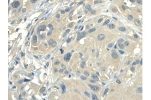 Detection of ALDH1A2 in Human Esophagus Tissue using Polyclonal Antibody to Aldehyde Dehydrogenase 1 Family, Member A2 (ALDH1A2) (ALDH1A2 antibody  (AA 1-422))