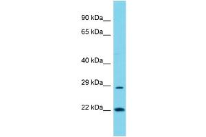 Host: Rabbit Target Name: POLR3G Sample Type: COLO205 Whole Cell lysates Antibody Dilution: 1. (POLR3G antibody  (Middle Region))