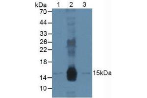 Figure. (DDB2 antibody  (AA 166-383))