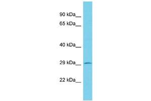 Host: Rabbit Target Name: KCTD2 Sample Type: RPMI-8226 Whole Cell lysates Antibody Dilution: 1. (KCTD2 antibody  (C-Term))