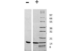 SDS-PAGE of Rat Leptin Recombinant Protein SDS-PAGE of Rat Leptin Recombinant Protein. (Leptin Protein (LEP))