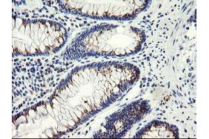 Immunohistochemical staining of paraffin-embedded Human colon tissue using anti-ACBD3 mouse monoclonal antibody. (ACBD3 antibody)