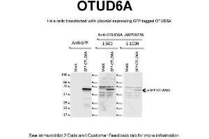 WB Suggested Anti-OTUD6A Antibody Titration: 2 ug/mlPositive Control: Human HeLa Cell line (OTUD6A antibody  (N-Term))