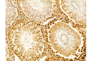 anti-AFG3-Like Protein 2 (AFG3L2) (C-Term) antibody