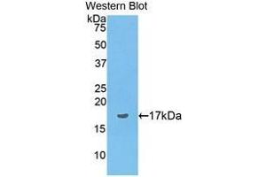 Western Blotting (WB) image for anti-Preprovasopressin (AA 24-168) antibody (ABIN1176179) (Preprovasopressin (AA 24-168) antibody)