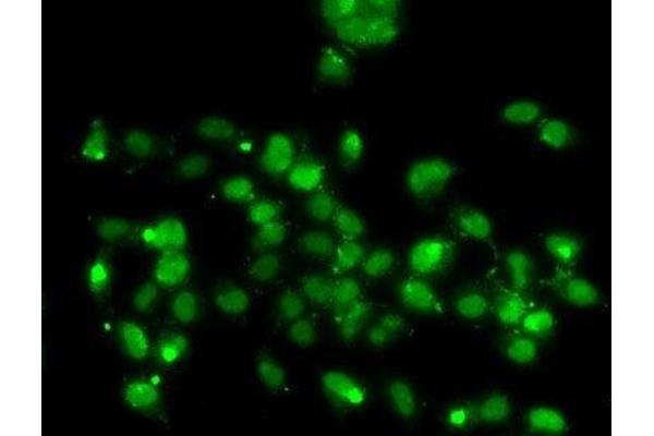 WBSCR22 antibody
