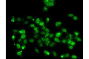 Immunofluorescence analysis of A-549 cells using WBSCR22 Polyclonal Antibody (WBSCR22 antibody)
