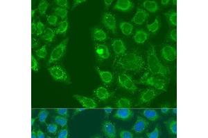 Immunofluorescence analysis of U2OS cells using HSD17B3 Polyclonal Antibody at dilution of 1:100. (HSD17B3 antibody)