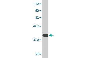 Western Blot detection against Immunogen (36. (RAB7B antibody  (AA 100-199))