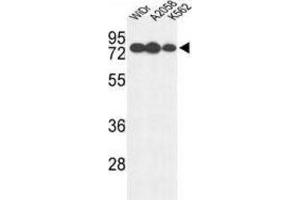 Western Blotting (WB) image for anti-Glucuronidase, beta (GUSB) antibody (ABIN3004140) (Glucuronidase beta antibody)