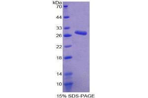 SDS-PAGE (SDS) image for Anoctamin 1, Calcium Activated Chloride Channel (ANO1) (AA 20-239) protein (His tag) (ABIN2124027) (ANO1 Protein (AA 20-239) (His tag))