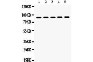 Western Blotting (WB) image for anti-Heat Shock Protein 90kDa alpha (Cytosolic), Class B Member 1 (HSP90AB1) (AA 449-481), (C-Term) antibody (ABIN3042462) (HSP90AB1 antibody  (C-Term))