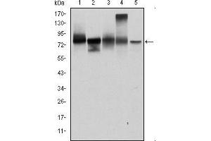 Western blot analysis using JUP mouse mAb against T47D (1), MCF-7 (2), SKBR-3 (3), A431 (4) and HEK293 (5) cell lysate. (JUP antibody)