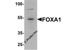 Western Blotting (WB) image for anti-Forkhead Box A1 (FOXA1) antibody (ABIN1077450) (FOXA1 antibody)