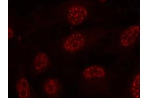 Immunofluorescence staining of methanol-fixed Hela cells using MAPKAPK-2(Phospho-Thr334) Antibody. (MAPKAP Kinase 2 antibody  (pThr334))