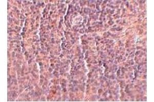 Immunohistochemistry (IHC) image for anti-ORAI Calcium Release-Activated Calcium Modulator 3 (ORAI3) (C-Term) antibody (ABIN492535) (ORAI3 antibody  (C-Term))