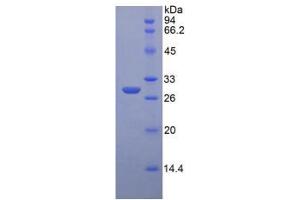 SDS-PAGE analysis of Mouse Insulin Like Growth Factor 2 Receptor (IGF2R) Protein. (IGF2R Protein)