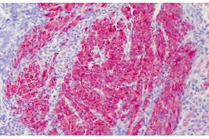 Human Myometrium: Formalin-Fixed, Paraffin-Embedded (FFPE) (Calponin antibody  (AA 1-298))