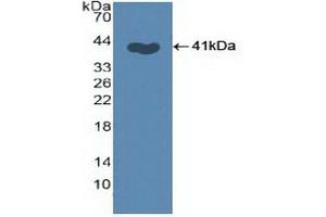 Detection of Recombinant SKP2, Human using Polyclonal Antibody to S-Phase Kinase Associated Protein 2 (SKP2) (SKP2 antibody  (AA 43-397))