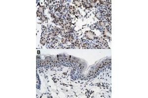 Immunohistochemical staining (Formalin-fixed paraffin-embedded sections) of human pancreas (A) and human skin (B) with GTF2I polyclonal antibody  at 4-8 ug/mL working concentration. (GTF2I antibody  (N-Term))