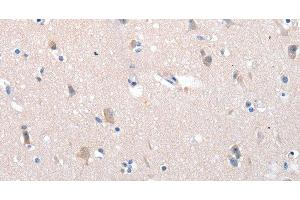 Immunohistochemistry of paraffin-embedded Human brain using YWHAG Polyclonal Antibody at dilution of 1:100 (14-3-3 gamma antibody)